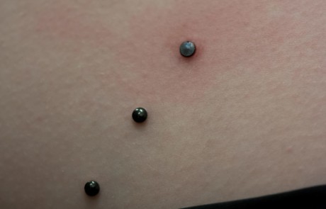 16229813_406029509739717_1362946719_o-1 dermal piercings