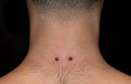 Screen-Shot-2017-01-23-at-01.19.27-1 piercings Dublin The Ink Factory