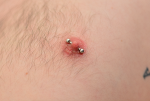 nipple piercing